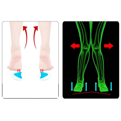 Arch Support Orthopedic Insole